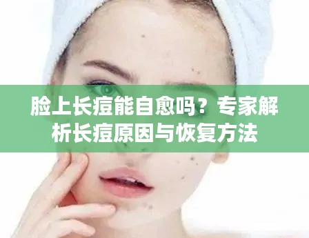 脸上长痘能自愈吗?专家解析长痘原因与恢复方法