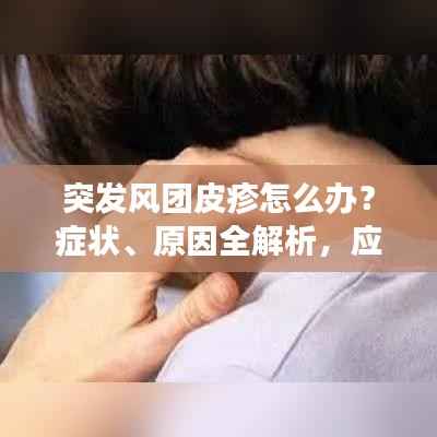 突发风团皮疹怎么办?症状、原因全解析,应对之策一网打尽!